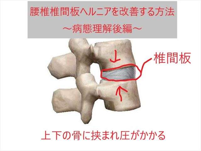 脳ヘルニアの合併症