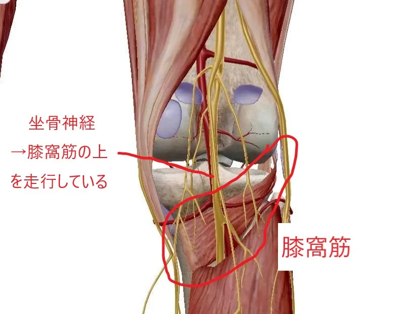【新宮市の整体で腰痛治療なら】坐骨神経痛改善方法～膝裏の膝窩筋を緩める～